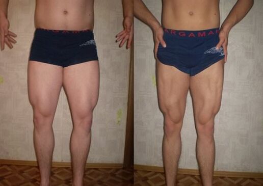 sebelum dan selepas mengikuti diet keto