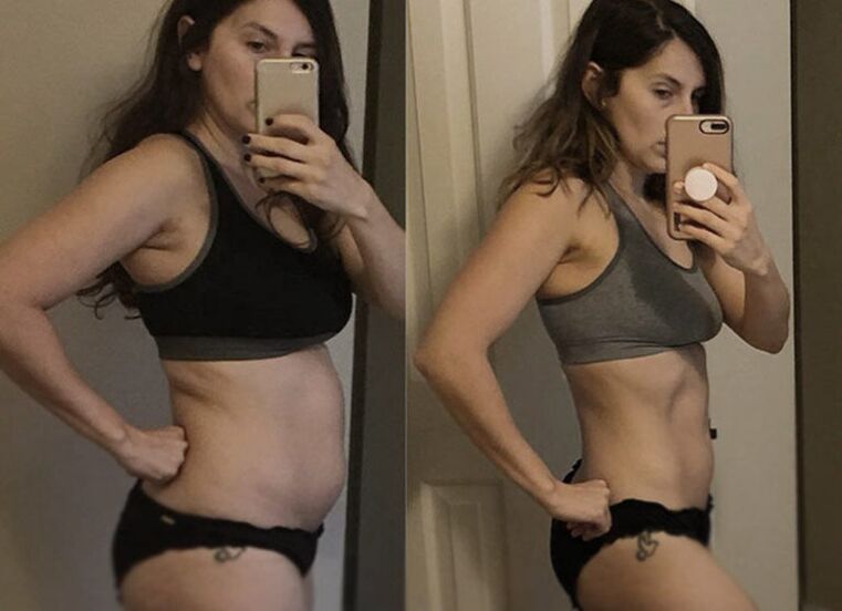 Gadis sebelum dan selepas diet keto